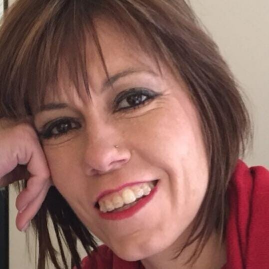 Resultados excelentes en Isabel con tratamiento con máquina de gorro frío de Anuel tras su quimioterapia.