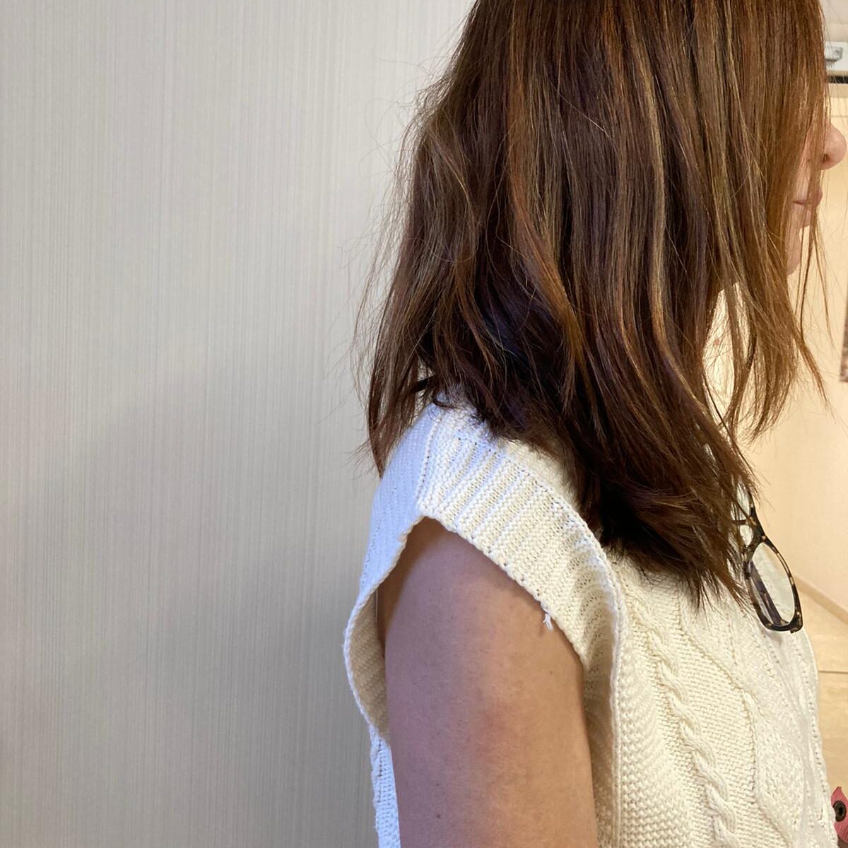 Resultados excelentes en Pilar con tratamiento con máquina de gorro frío de Anuel tras su quimioterapia.